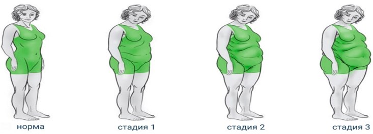 н1.png